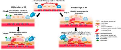 The Role of Immune and Inflammatory Cells in Idiopathic Pulmonary Fibrosis